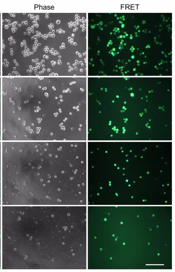 Микрофотографии раковых клеток в фазовом контрасте и режиме FRET, демонстрирующие их разрушение под воздействием механического напряжения, имитирующего интенсивный кровоток