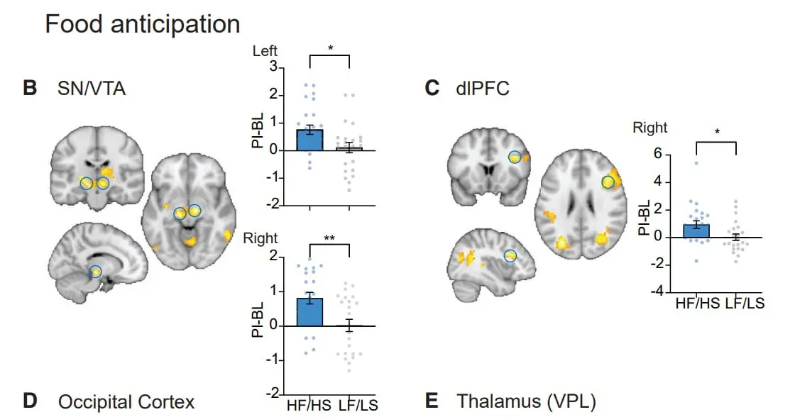 Активность мозга во время предвкушения еды